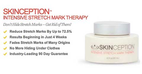 Benefits of Skinception Stretch Mark