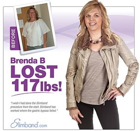 Gastric band success stories