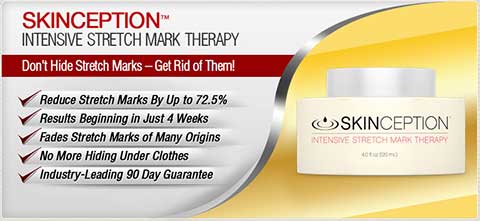 Skinception Stretch Mark Cream